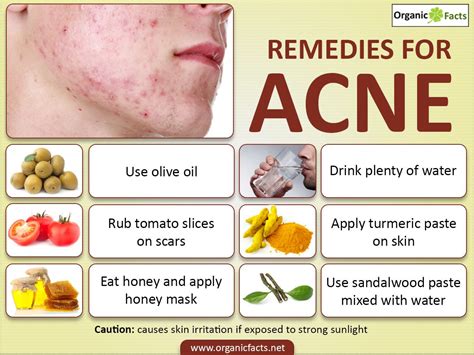 Natural Remedies to Combat Pimple Outbreaks