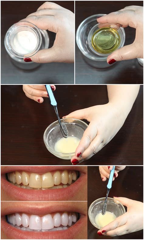 Naturally Enhance Your Smile: Home Remedies and Effective DIYs