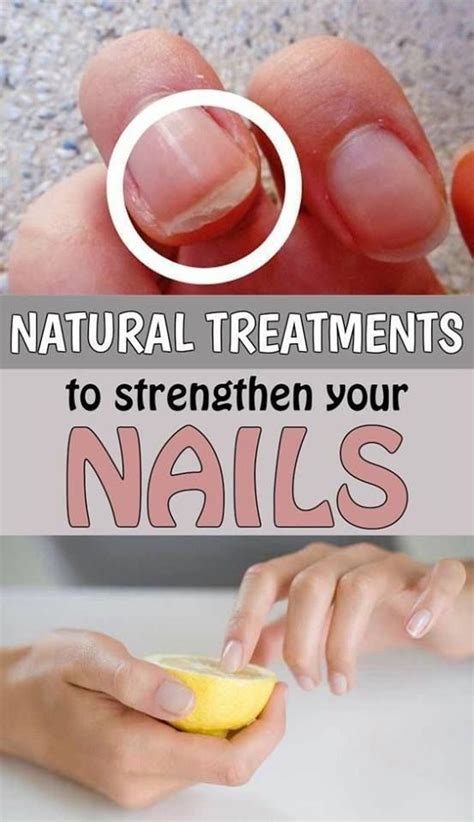 Nurturing Your Natural Nails: Home Remedies to Strengthen Fragile Nails