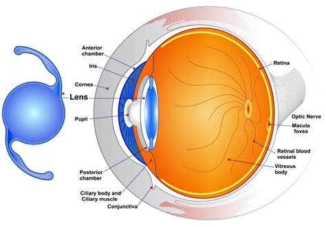 Overcoming the Challenges of Developing Alternatives to Corrective Eye Lenses