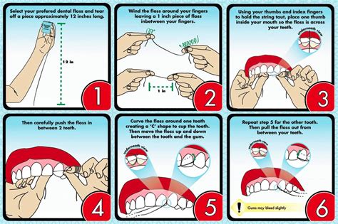 Perfecting Your Flossing Technique: A Step-by-Step Guide