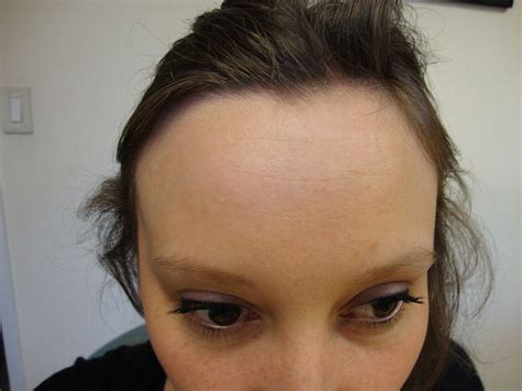 Personalized Interpretations: How Context Shapes the Meaning of an Injured Forehead