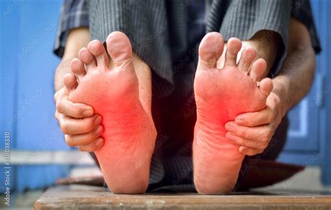 Physical Conditions that May Trigger Experiencing Sensations of Fiery Feet