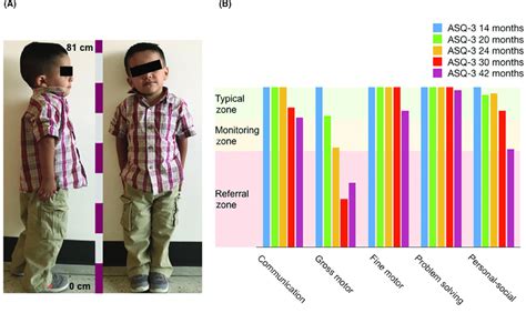 Physical Stature: Examine the Differences in the Twins' Height