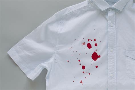 Possible Causes and Messages of Dreaming about Blood Stains in Trousers