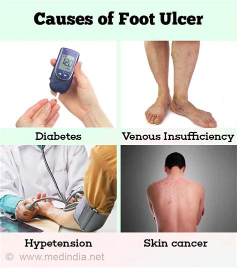 Possible Causes and Triggers for Experiencing Dreams About Foot Ulcers