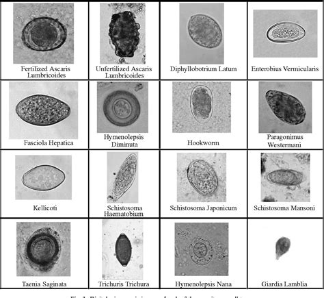 Possible Meanings of Eggs Overrun with Worms