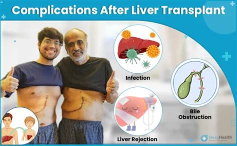 Potential Risks and Complications of Liver Donation