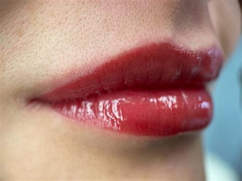 Preparing Your Lips for a Picture-Perfect Pout