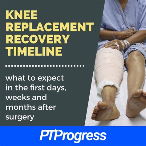 Preparing for Knee Surgery: What to Expect