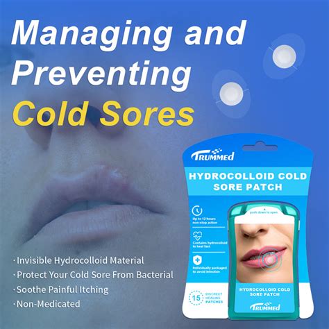 Preventing Cold Sores: Strategies for Minimizing the Frequency of Outbreaks