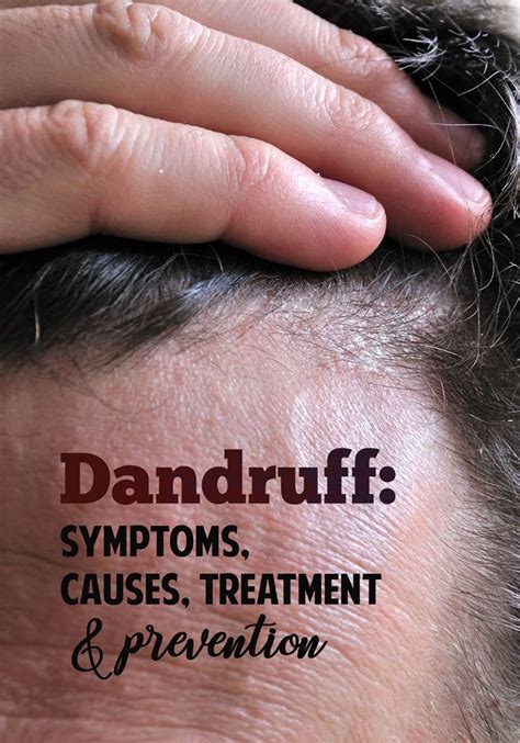 Preventing Dandruff: Maintaining Healthy Haircare Habits for a Flake-Free Scalp