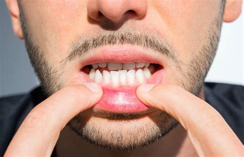 Preventing Health Issues byEnsuring Proper Alignment of Your Teeth