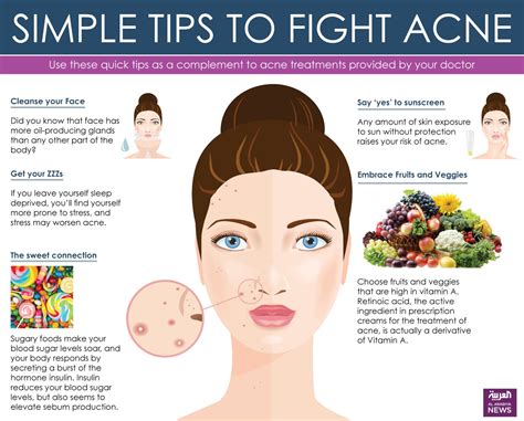 Preventing Severe Acne: Habits and Lifestyle Changes