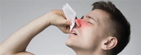 Prevention is Key: Tips to Avoid Epistaxis in the Future