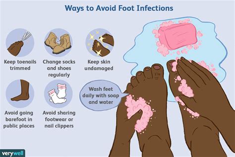 Prevention is Key: Tips to Avoid Fungal Infections on Your Feet