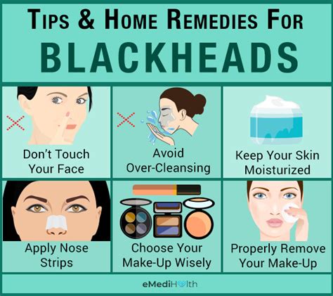 Preventive Measures: Tips for Blackhead Prevention