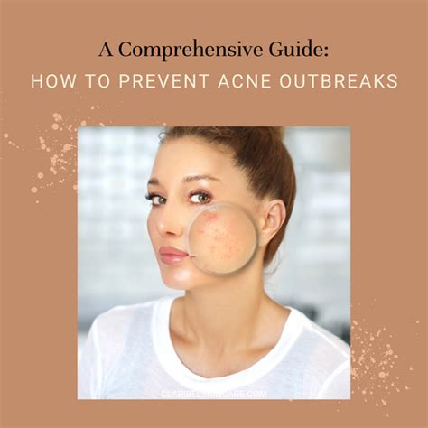 Preventive Measures to Avoid Severe Acne Outbreaks