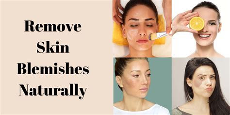 Professional Solutions for Large Skin Blemishes - Essential Tips