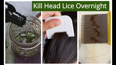 Proven Methods to Eliminate Head Lice at Home