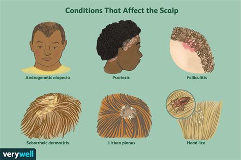 Recognizing Symptoms of an Affected Area on the Scalp