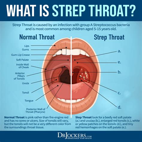 Recognizing the Indications of a Painful Throat