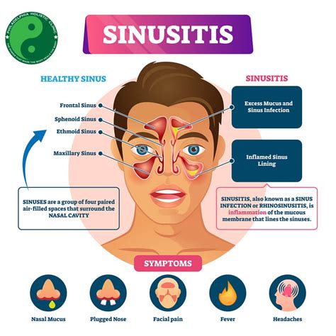 Recognizing the Physical Signs of Nasal Infection Manifested in Dreamscapes