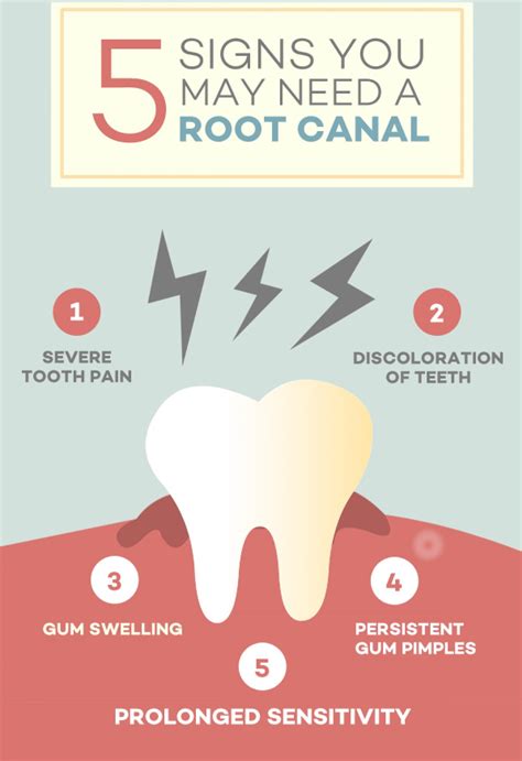 Recognizing the Signs and Symptoms: Indicators of the Need for a Root Canal