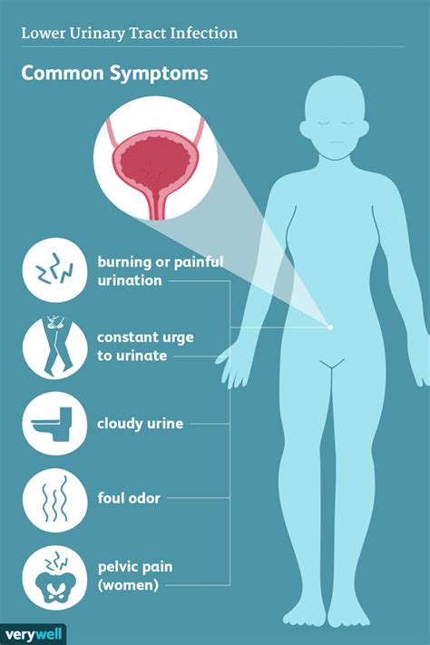 Recognizing the Signs of Bladder Infection