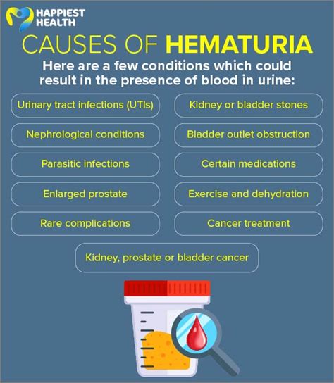 Recognizing the Symptoms of Hematuria and Seeking Medical Help