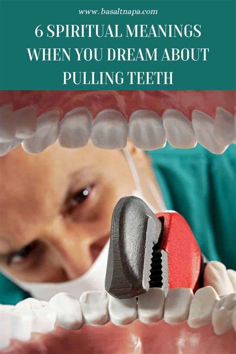 Relating to Extra Teeth Dreams: Making Sense of Personal Experiences