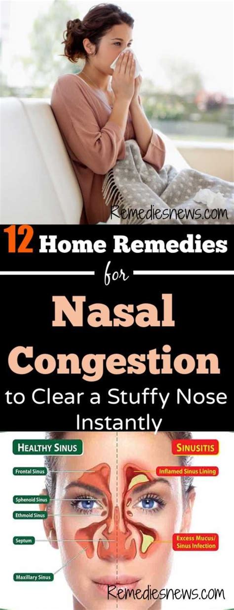 Relieving Nasal Congestion: Natural Remedies for Clear Breathing