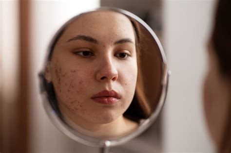 Say Farewell to Imperfections: Effective Remedies and Strategies for Blemishes