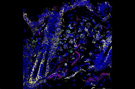 Scratching Beneath the Surface: Analyzing the Itchiness of Fleas in Dream