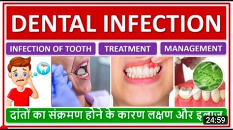 Seeking Effective Treatment for Dental Infections