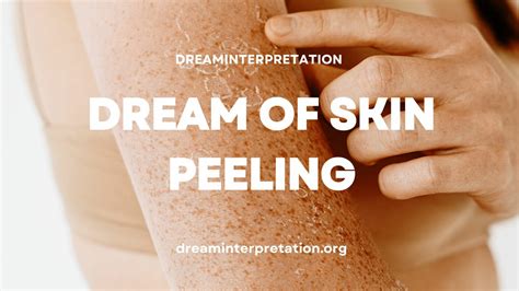 Shedding Old Identities: Analyzing the Role of Peeling Dehydrated Skin in Dream Interpretation