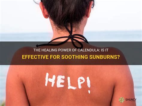 Soothing Sunburns and Relieving Itching with the Power of Baking Soda