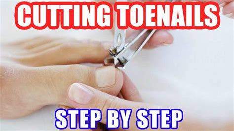 Step-by-Step Guide to Safely Trim Overgrown Toenails