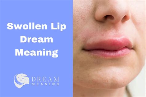 Symbolism and Interpretations of Dreaming about a Swollen Lip