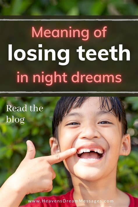 Symbolism and Meaning of Dreaming about Losing a Tooth