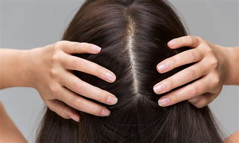 Taking Care of Your Scalp: Healthy Habits for Promoting Hair Growth and Scalp Health