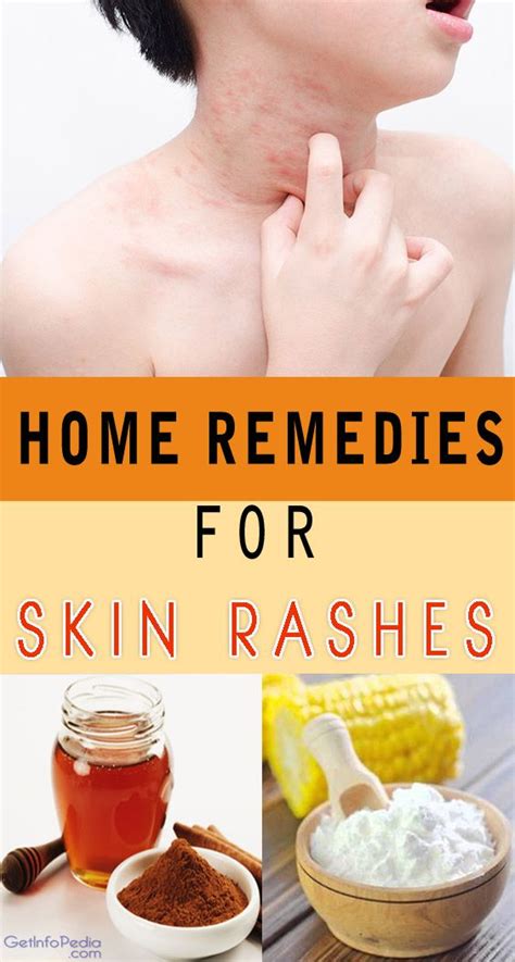 Taming the Itch: Effective Home Remedies for Skin Hives