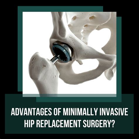 The Advantages of Hip Surgery: Enhancing Mobility and Quality of Life