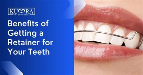 The Advantages of Wearing Dental Retainers