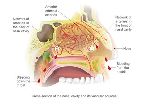 The Anatomy of a Bleeding Nose