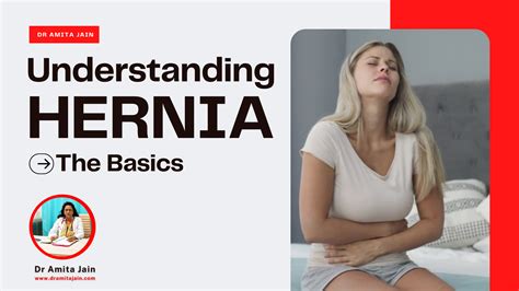 The Basics: Understanding Hernia