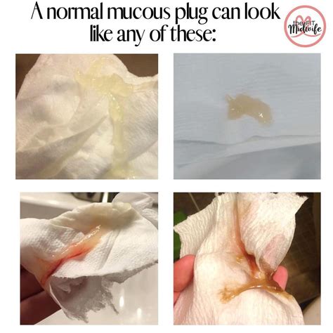 The Biological Process: What is a Mucus Plug?