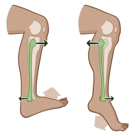 The Curious Phenomenon of Dysfunction in Lower Limb Joints During Reverie