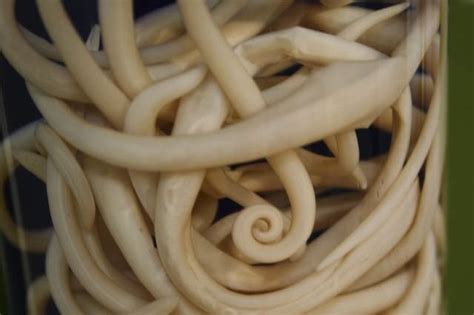 The Curious Phenomenon of Tapeworm Enthusiasm