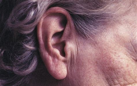 The Dangers of Accumulated Earwax